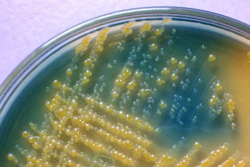figure bacterial colonies on CLED agar