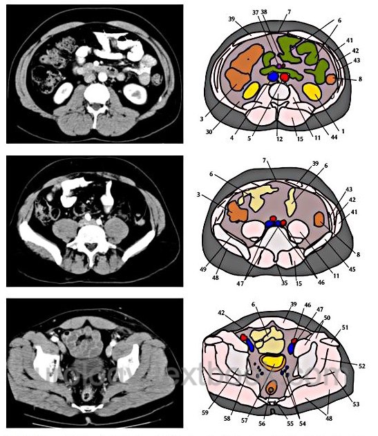 figure Normal Findings and Sectional Anatomy of abdominal and pelvic CT Scans