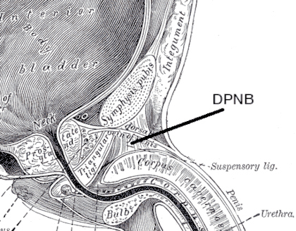 figure Penile nerve block: subpubic injections sites.